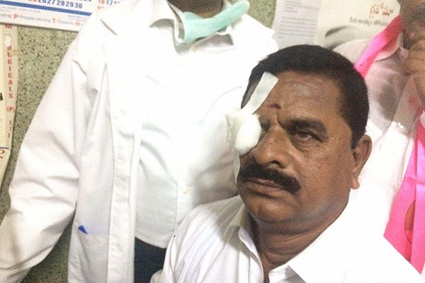 TRS alleges Congress MLAs came to the assembly drunk after one of them injured the Council Chairman