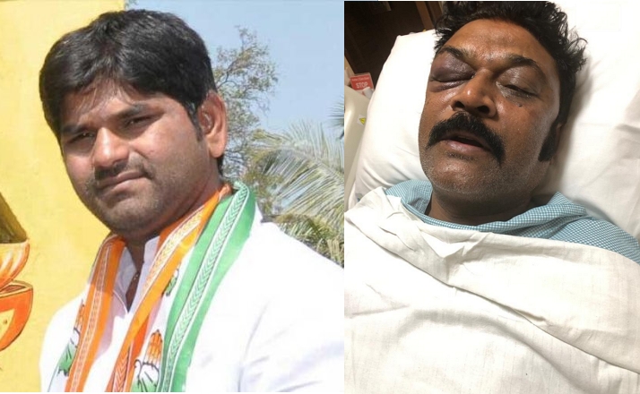 Karnataka: Congress MLA JN Ganesh missing after assaulting MLA, injured MLA Anand Singh claims accused asked for a gun to kill him