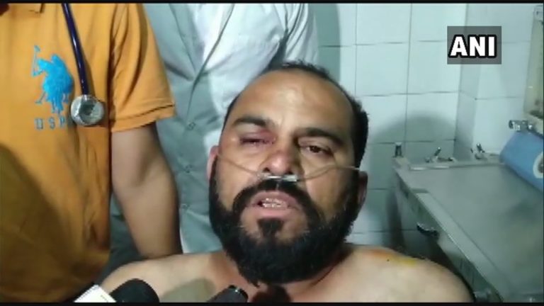 Man who slapped Hardik Patel at a rally in Gujarat explains why he did it