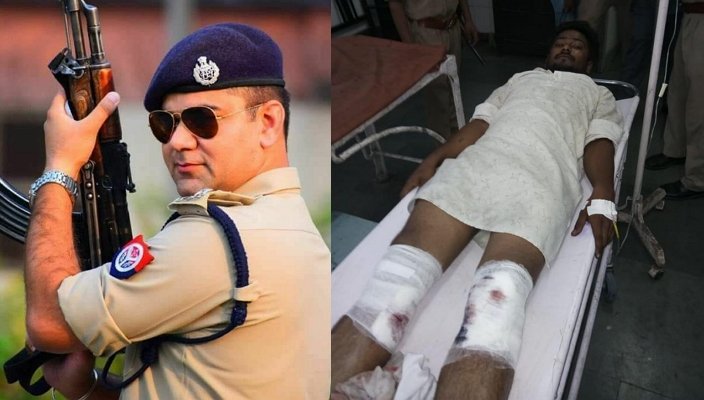 Uttar Pradesh: Rampur Police shoots Nazil, accused of abducting, raping and killing a 6-year-old girl