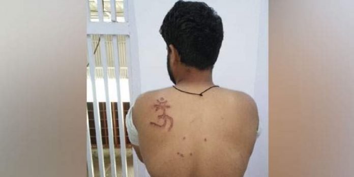 Tihar inmate Nabbir had got the brand on himself with the help of other inmates.