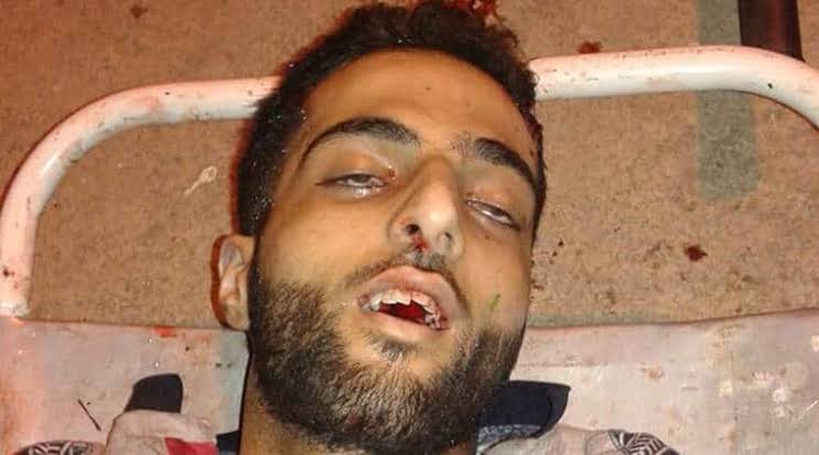 Pakistan joins hands with Break-India forces to glorify Hizbul Mujahideen terrorist Burhan Wani on his third death anniversary