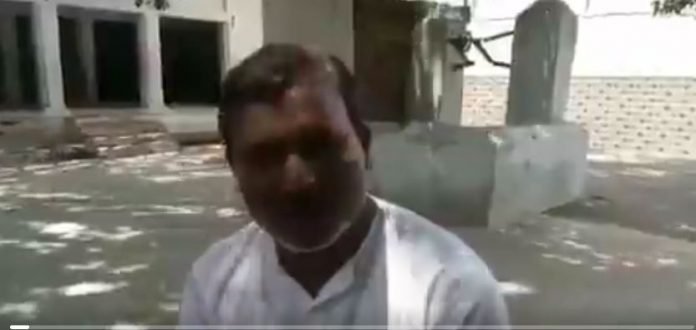 Chandauli police records statement of an eyewitness, Dinesh Maurya, who saw victim set himself on fire
