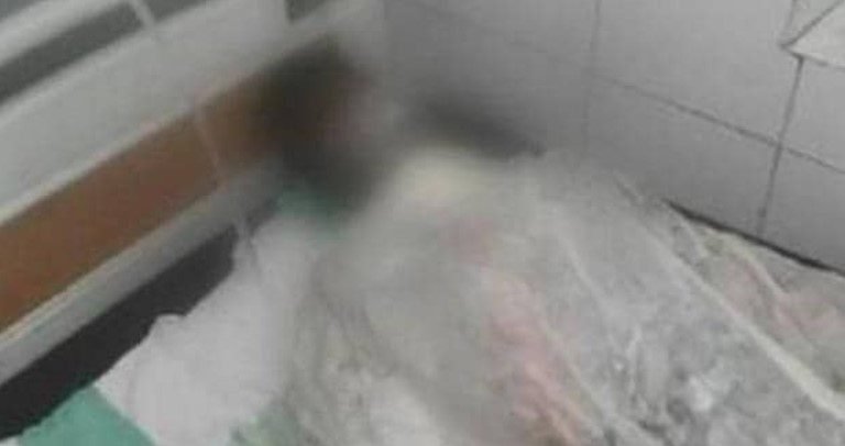 Chandauli: 17-year-old Khalid Ansari who set himself on fire in a dargah succumbed to his injuries