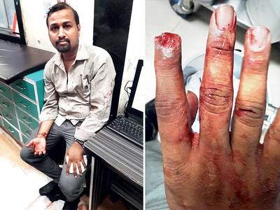 ‘Will tear your stomach apart’: One Asif Yusuf Shaikh bites off finger of victim, keeps abusing him even after spitting out severed finger
