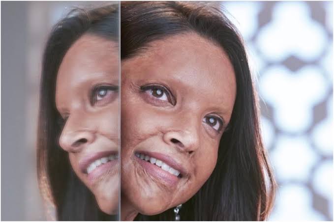 Chhapaak: Deepika Padukone starrer film fails to dazzle public, gets disappointing reviews from viewers on IMDb and Google