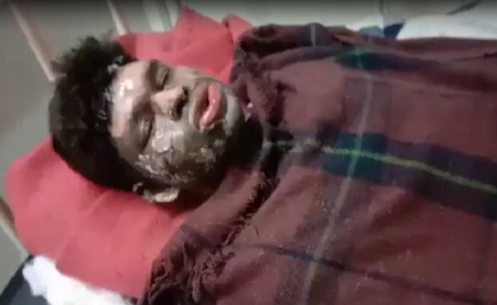 A Dalit youth Dhaniram Ahirwar was attacked and burnt by a mob of Muslim men in Sagar, Madhya Pradesh