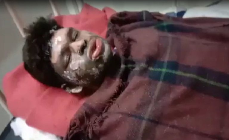 Dalit youth burnt alive in MP, BJP says Congress shielding accused from ‘minority community’ due to appeasement politics