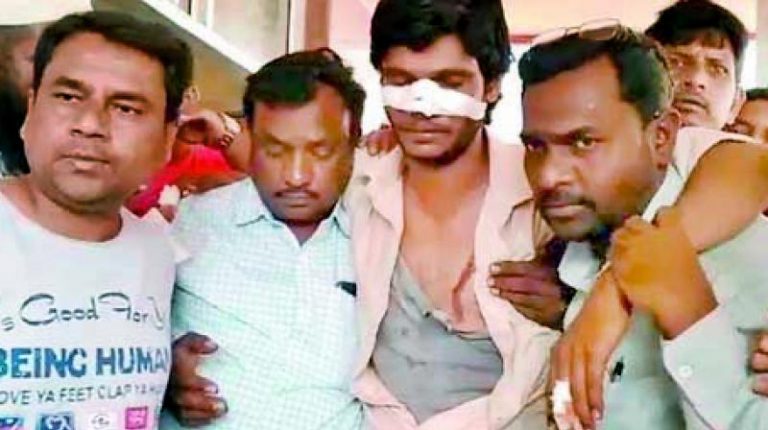 Congress candidate Ilias bites off TRS candidate Imran’s nose in Telangana during local body elections: Read why