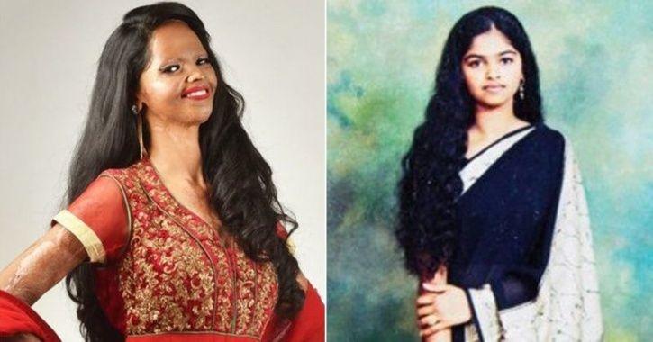 The real story of Chhapaak: When 32-year-old Naeem threw acid on 15-year-old Laxmi’s face because she refused his marriage proposal