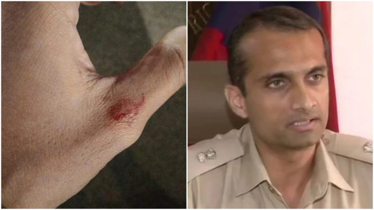 Female protestor from JNU mob attacks and bites Additional DCP Southwest’s hand