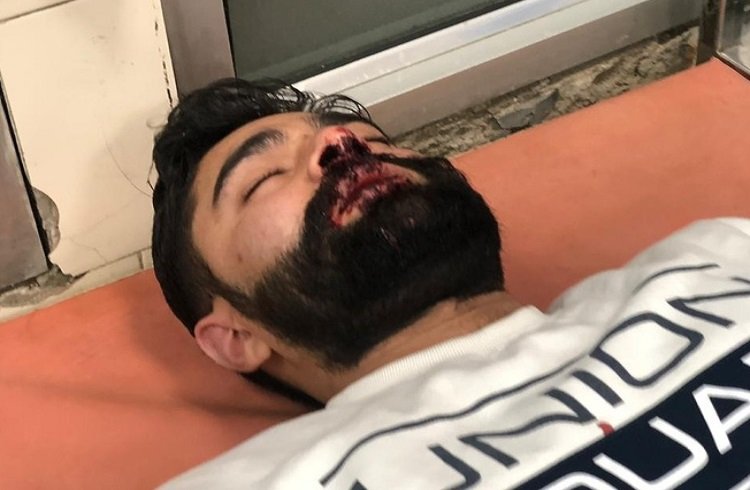 Panjab University student injured after left-wing goons attack him for a social media post criticising leftist student organisation