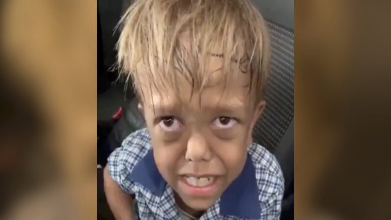 Is Quaden Bayles, the kid in the viral video who got bullied in school, actually an 18-year-old actor? Here is the truth