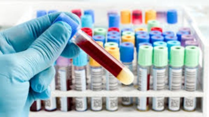 antibody test