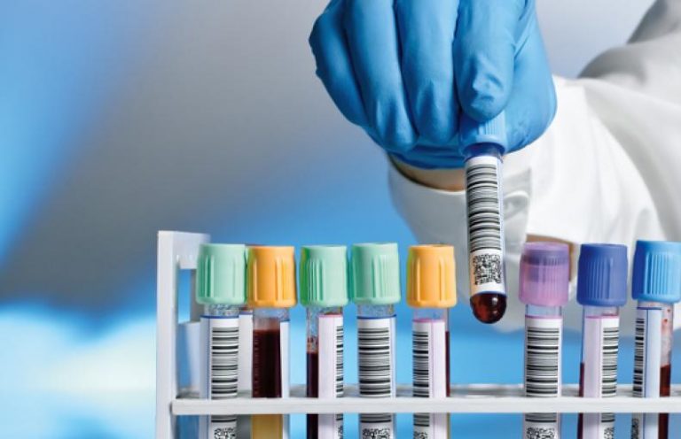 First and second confirmatory tests for COVID-19 are free for all citizens, only 10% capacity utilised yet: Health Ministry