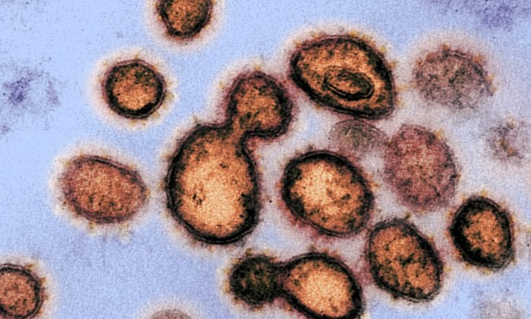 Loss of the senses of smell and taste could be symptoms of Coronavirus even when no other symptoms are seen, doctors say