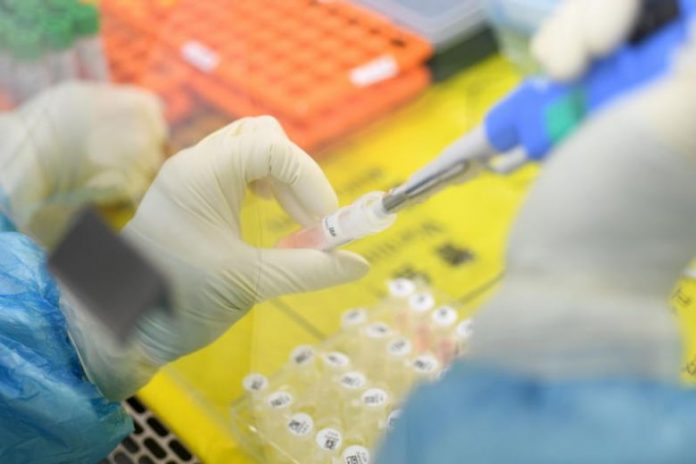 Chinese testing kits for detecting Wuhan virus are deemed faulty in Spain and Czech Republic