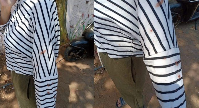 He removed his mask and spit on me, could expose me to Coronavirus: Man arrested for spitting on Manipur woman
