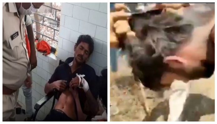 Health workers assaulted