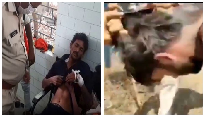 Madhya Pradesh: Sanitation workers attacked by a mob with axes, rods and sticks, one worker badly injured, main accused Adil arrested