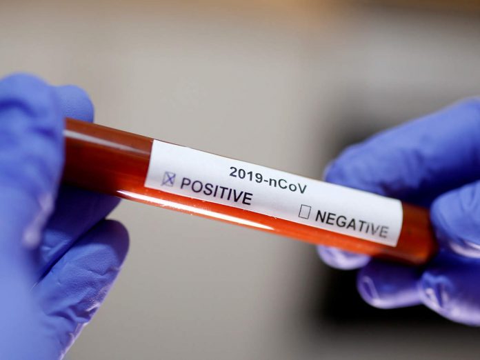 27 journalists of a Tamil TV channel in Chennai test positive for coronavirus