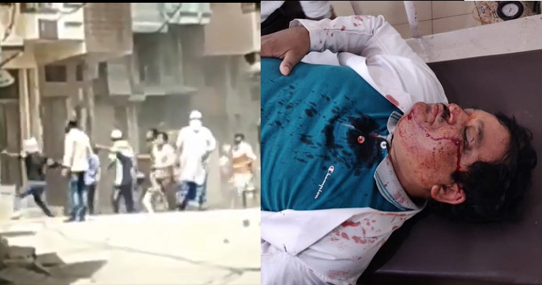 Uttar Pradesh: Team carrying coronavirus suspects to quarantine attacked by mob in Moradabad, doctors and others injured