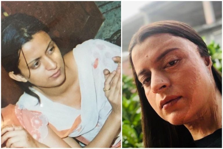 ‘You deserved acid attack, he should’ve thrown more of it’: Abusive tweeps wish another attack on Kangana Ranaut’s acid attack survivor sister
