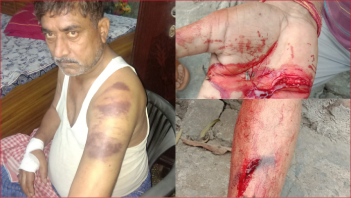 MCD worker Dharampal attacked by Shahrukh for asking to not litter on road