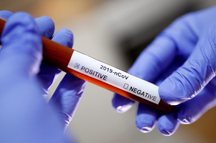 India records lowest coronavirus fatality rates in the world, says Union Home Ministry