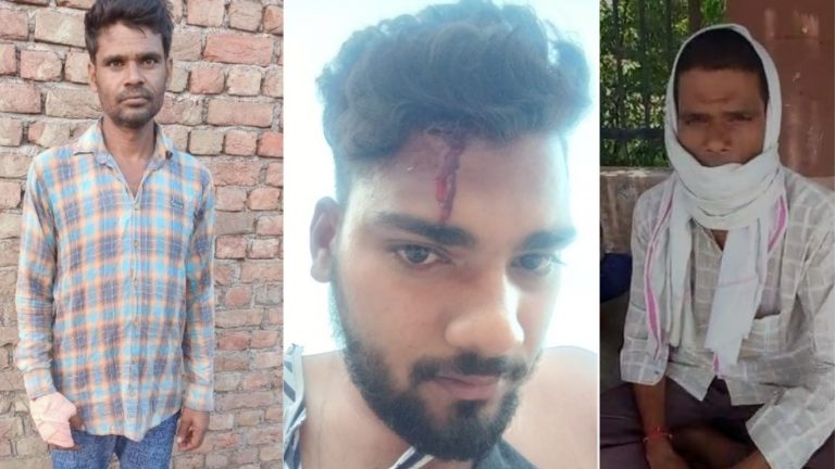 Haryana: Muslim mob attacks Dalit boy with a battle axe in Mewat, threatens to kill him and his family