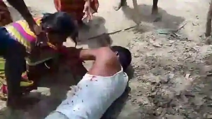 West Bengal: BJP district secretary Pabitra Das injured after getting shot in a clash with TMC workers