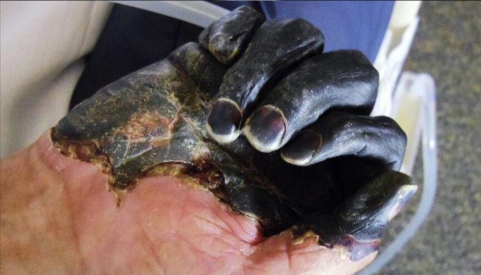 After Coronavirus pandemic and swine flu, a city in China now issues warning for bubonic plague