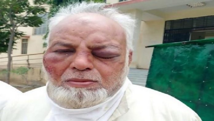 Muslim auto driver thrashed by history sheeters, communal angle unconfirmed