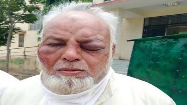 Rajasthan: Muslim auto driver was thrashed by drunk miscreants for tobacco and money, communal angle not confirmed by police