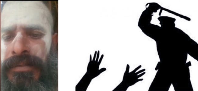 NCPCR takes cognisance of complaint against Anthony Michael for beating up children of Sadhu Saravanan