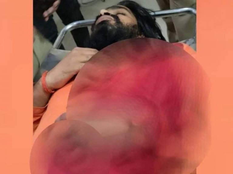 Uttar Pradesh: Ram Janki temple Pujari shot at in Gonda, two arrested