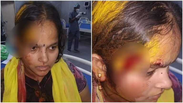 Hyderabad woman assaulted by neighbour ‘Yesu’ for doing puja in a temple: Read details