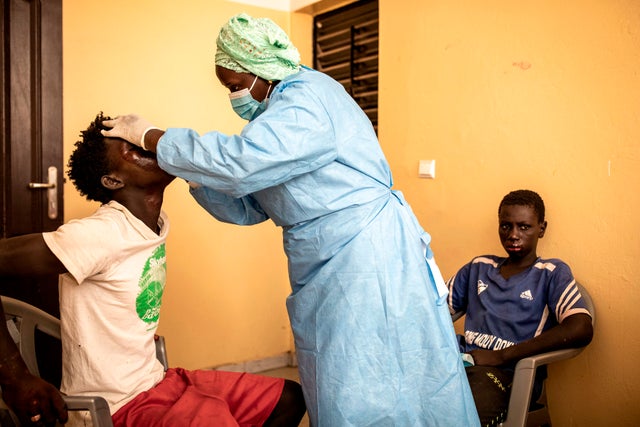 Hundreds of fishermen contract mysterious skin disease in Senegal, suffer from lesions on the face, extremities and skin rash