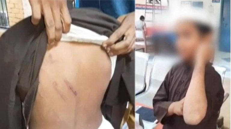 Pilibhit: 12-year-old boy escapes from madrassa alleging he was chained and tortured by his teacher