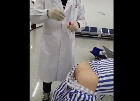Chinese doctor demonstrates how to take anal swab test in viral video