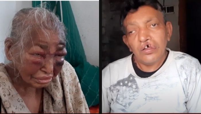 While Trinamool Congress projects Mamata Banerjee as ‘Bengal’s daughter’, goons assault the mother of a BJP supporter, give death threats