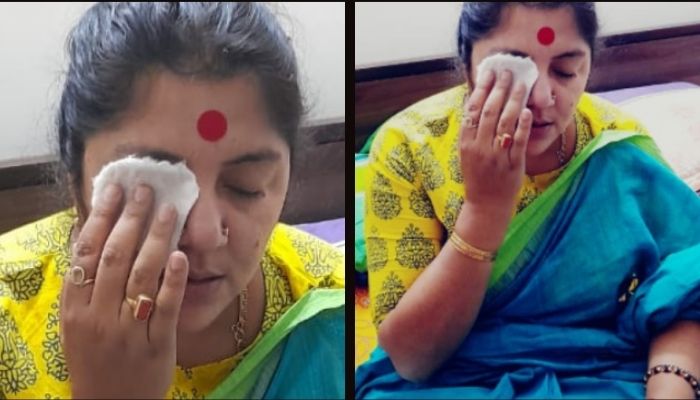 West Bengal BJP leader Locket Chatterjee attacked with chemical-laced colours by TMC goons