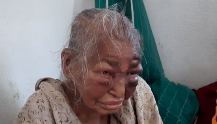 Elderly mother of BJP worker, attacked by TMC, dies, ‘TMC’s politics of violence has bruised Bengal’s soul’ says BJP