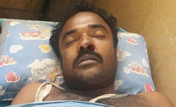 West Bengal: Dead body of BJP worker recovered after he went missing, party accuses TMC workers of murder