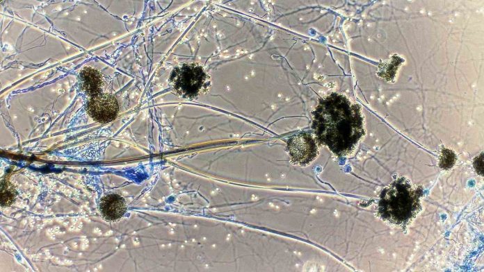 Rajasthan govt notifies Mucormycosis aka black fungus as an 'epidemic'