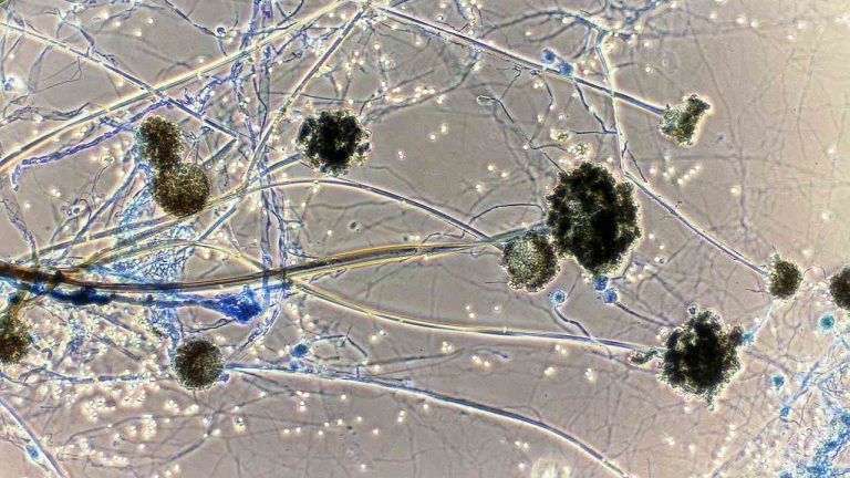 Black fungus scare: Rajasthan govt declares mucormycosis as an epidemic, separate treatment ward set up in Jaipur