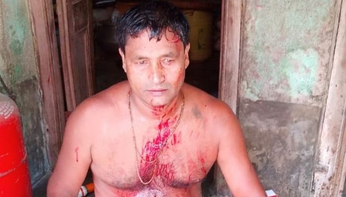 BJP worker brutally assaulted, bleeds profusely from the head after being attacked by TMC goon
