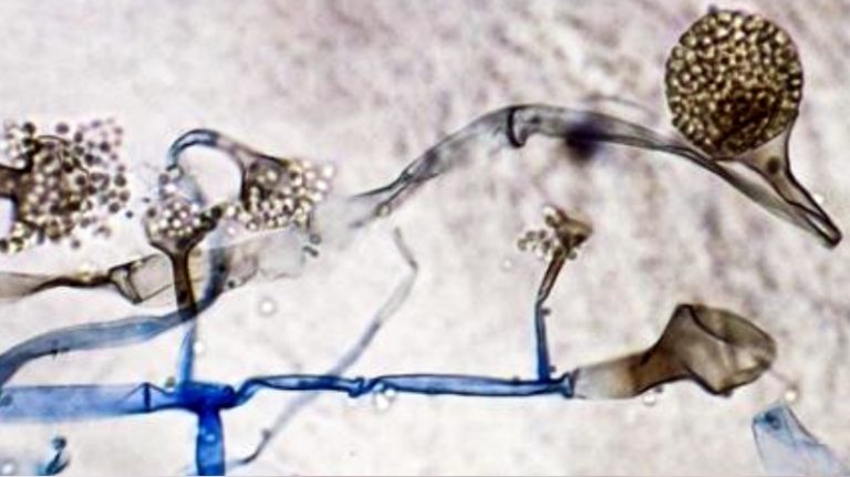 As Black Fungus cases rise, experts say it is not an infection that is contagious: Read details