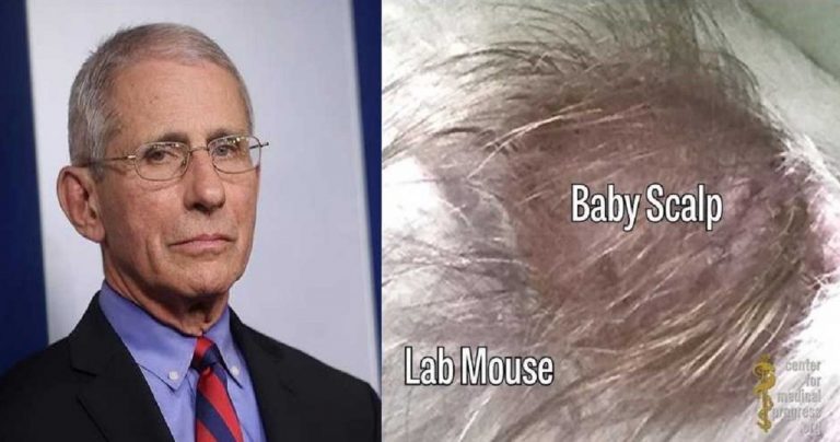 Anthony Fauci led NIAID funded horrific experiments where scalps of aborted babies were stitched to the back of lab rats