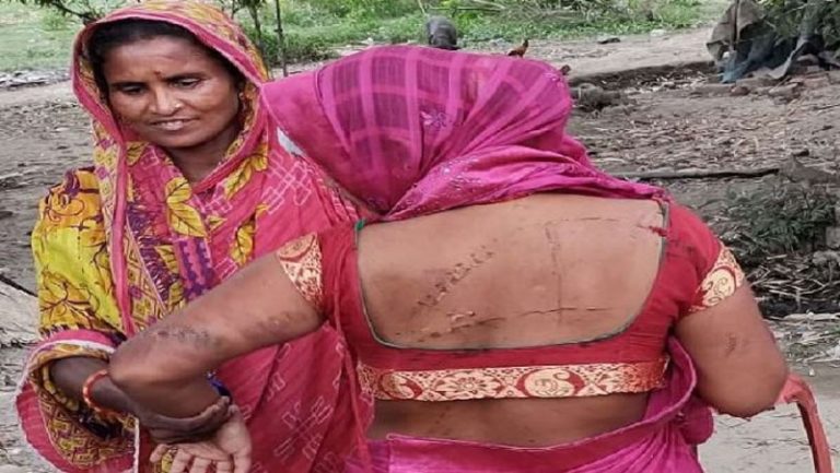 Islamist mob tried to rape a pregnant woman, ASHA worker saved herself by escaping in half-naked condition: Horror stories from Purnia emerge